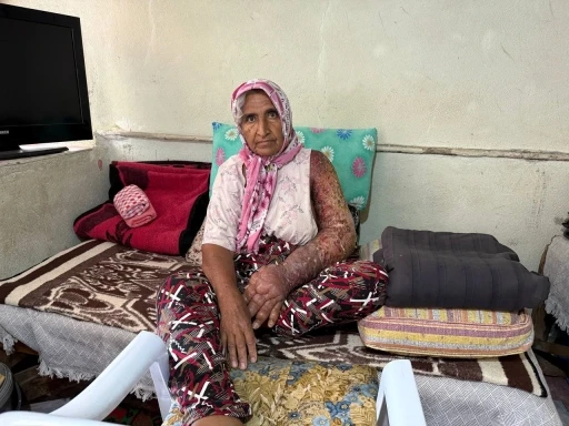 Kolu şişti, vücuduna kadar yara oldu: 4 çocuk annesinin zorlu yaşamı
