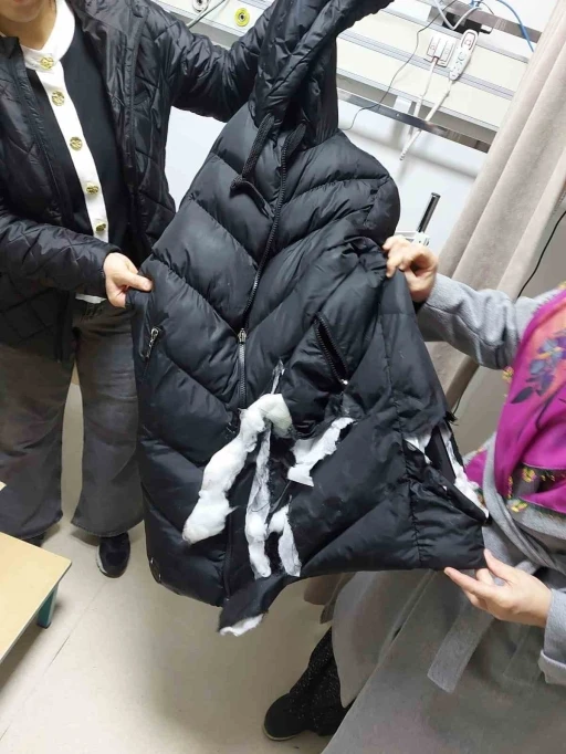 Köpeklerin saldırısına uğrayan kadın yaralandı: O anlar kameraya yansıdı
