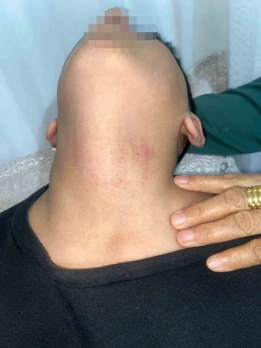 K&uuml;&ccedil;&uuml;k&ccedil;ekmece&rsquo;de kadın memurun 10 yaşındaki &ouml;ğrenciyi okulda darbettiği iddiası
