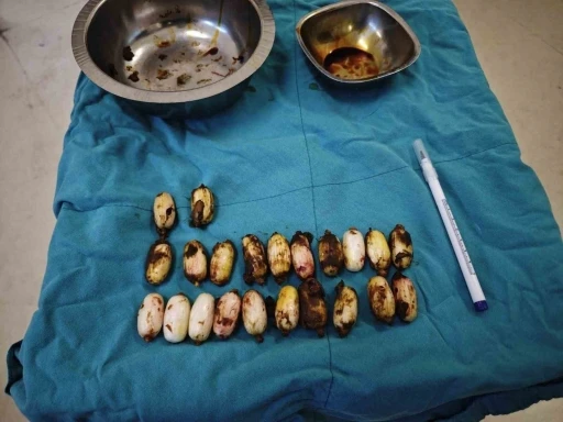 Midesinde taşıdığı uyuşturucu maddeler polisin dikkatinden sayesinde ele ge&ccedil;irildi
