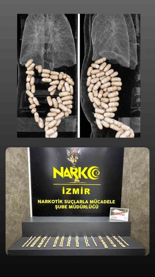 Midesinde uyuşturucu taşıyan ş&uuml;pheliler tutuklandı

