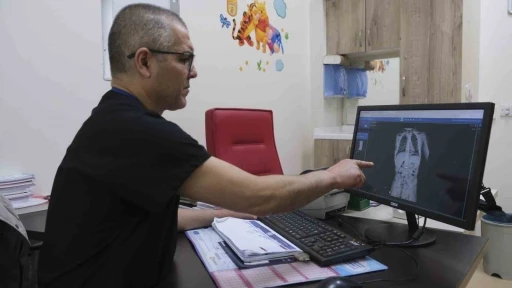 Mıknatıs yutan &ccedil;ocuk, ameliyatla sağlığına kavuştu
