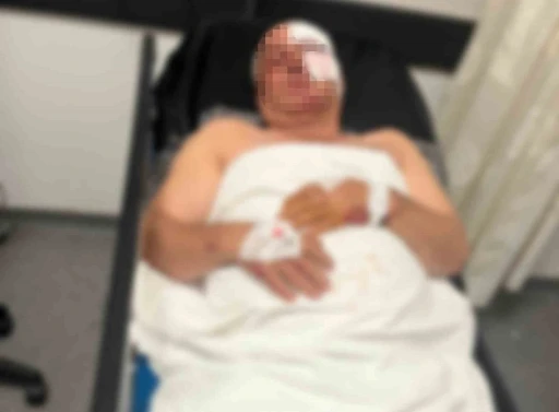 Motosiklet kazasında yaralandı, kardeşinin &ccedil;arptığını iddia etti
