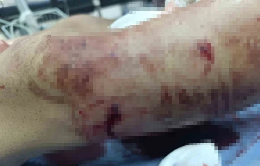 Muş’ta ayının saldırdığı çocuk yaralandı
