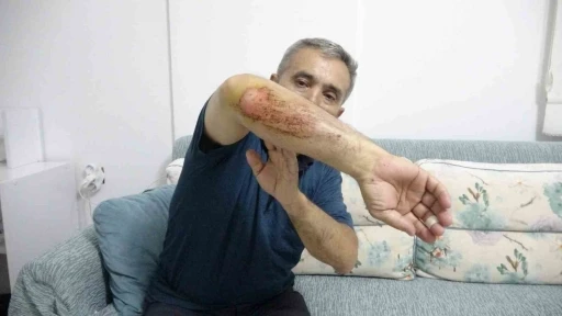 Otizmli oğluyla doğa gezisi sırasında sahipli k&ouml;peklerin saldırısına uğradı
