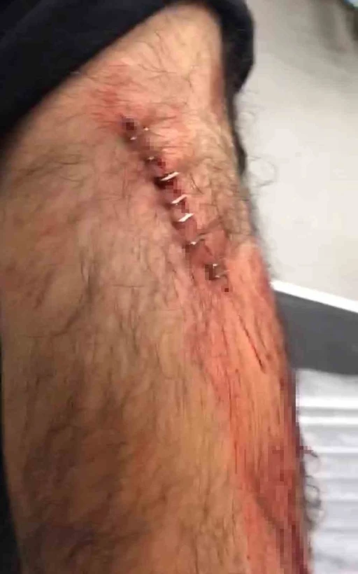 Şanlıurfa’da görev yapan öğretmene sokak ortasında jiletli saldırı
