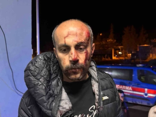 Şanlıurfa’da müvekkilinin yanına giden avukata darp iddiası

