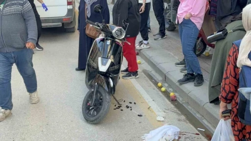Scooterin &ccedil;arptığı yaya yaralandı
