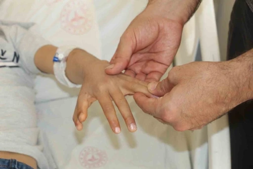 Şırnak&rsquo;ta yapışık parmaklı iki kardeş ameliyatla sağlıklarına kavuştu
