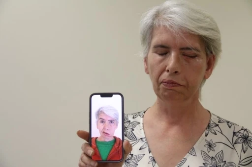 Sol gözünü 30 yıl sonra 24 ayar altınla yapılan tedavi sonucu kapattı
