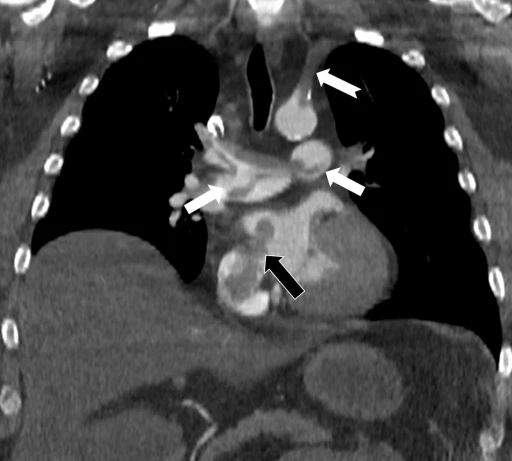 Tekden&rsquo;de başarılı &ccedil;alışmalara imza atan radyoloji uzmanından hayati tespit
