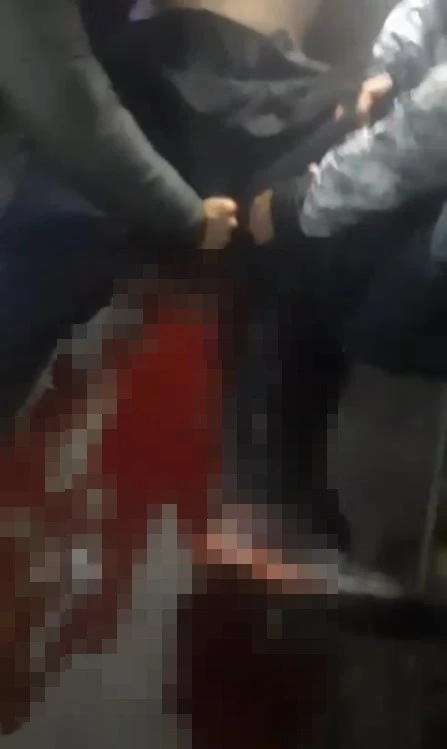 Üsküdar’da bıçaklı kavga : 1 yaralı
