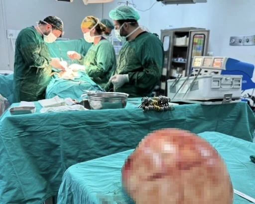 Van&rsquo;da bir kadının karnından 35 santimetrelik dev kitle &ccedil;ıkarıldı
