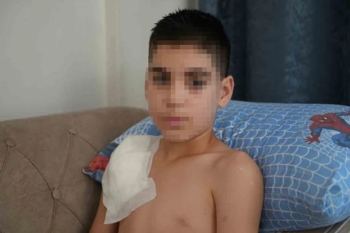 Vücudu köpek tarafından parçalanan Yunus’un kolu kullanılamaz hale geldi, aile adalet arıyor
