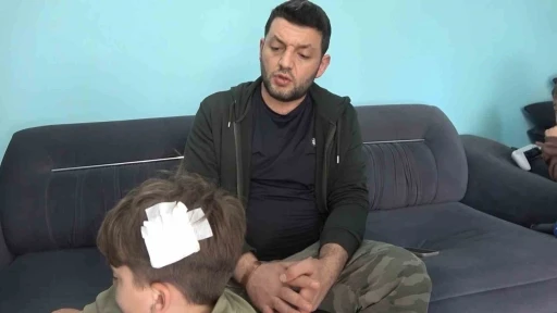 Yalova&rsquo;daki komşu kavgasında bu kez 8 yaşındaki &ccedil;ocuğa taşlı saldırı
