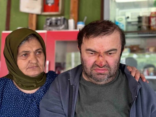 Yüzde 90 engelli vatandaş acımasızca darp edildi
